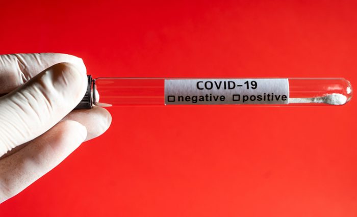 covid analiza tipuri de testare