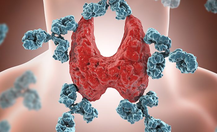 Civis Courses, autoimmune diseases - STIRE